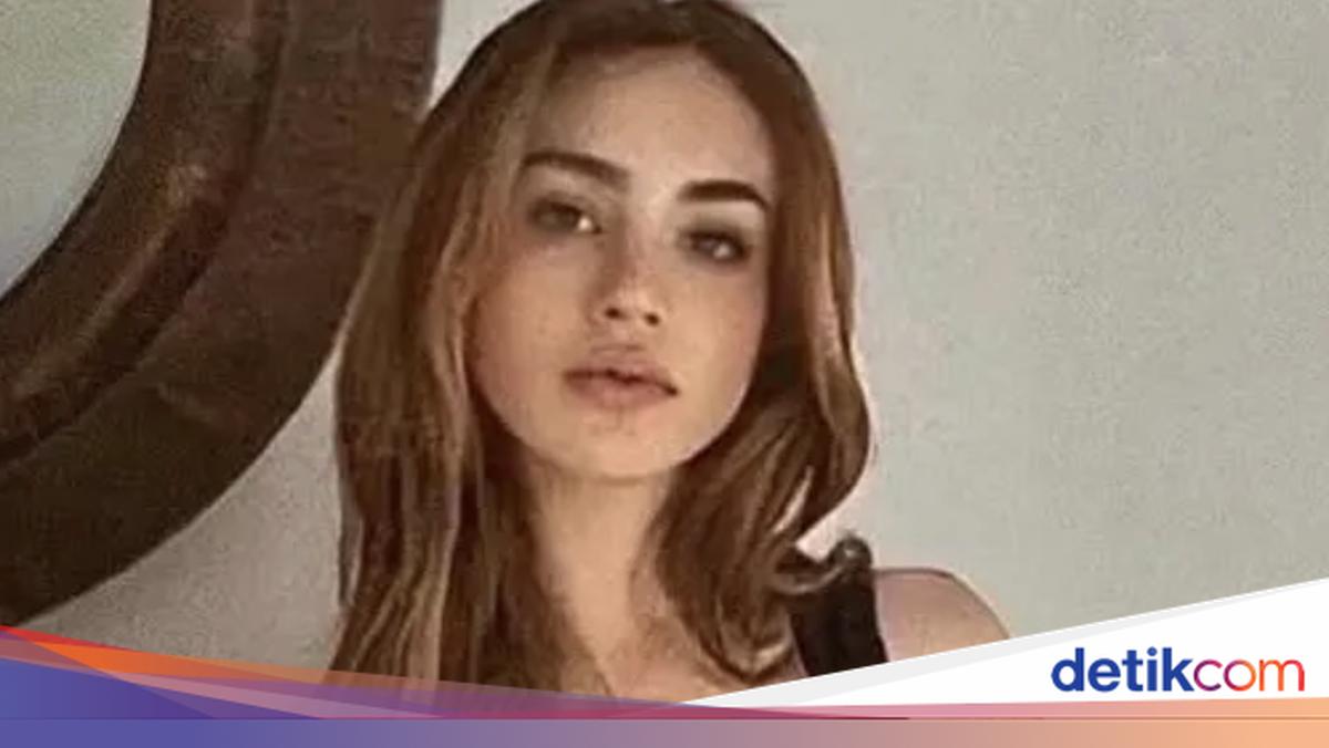 Perempuan Asal Kolombia Meninggal Saat Prosedur Pengangkatan Filler Bokong