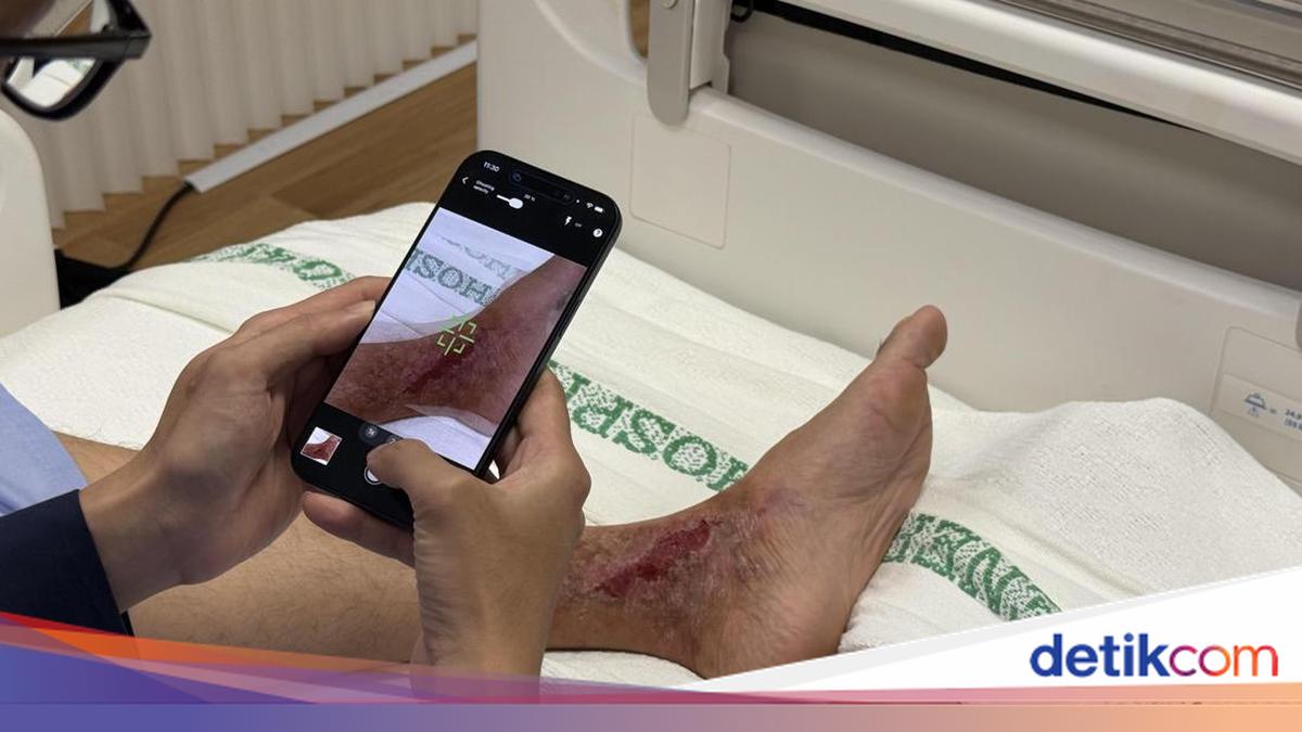 Cerita Dokter dan Perawat Pakai Gadget Apple untuk Rawat Pasien