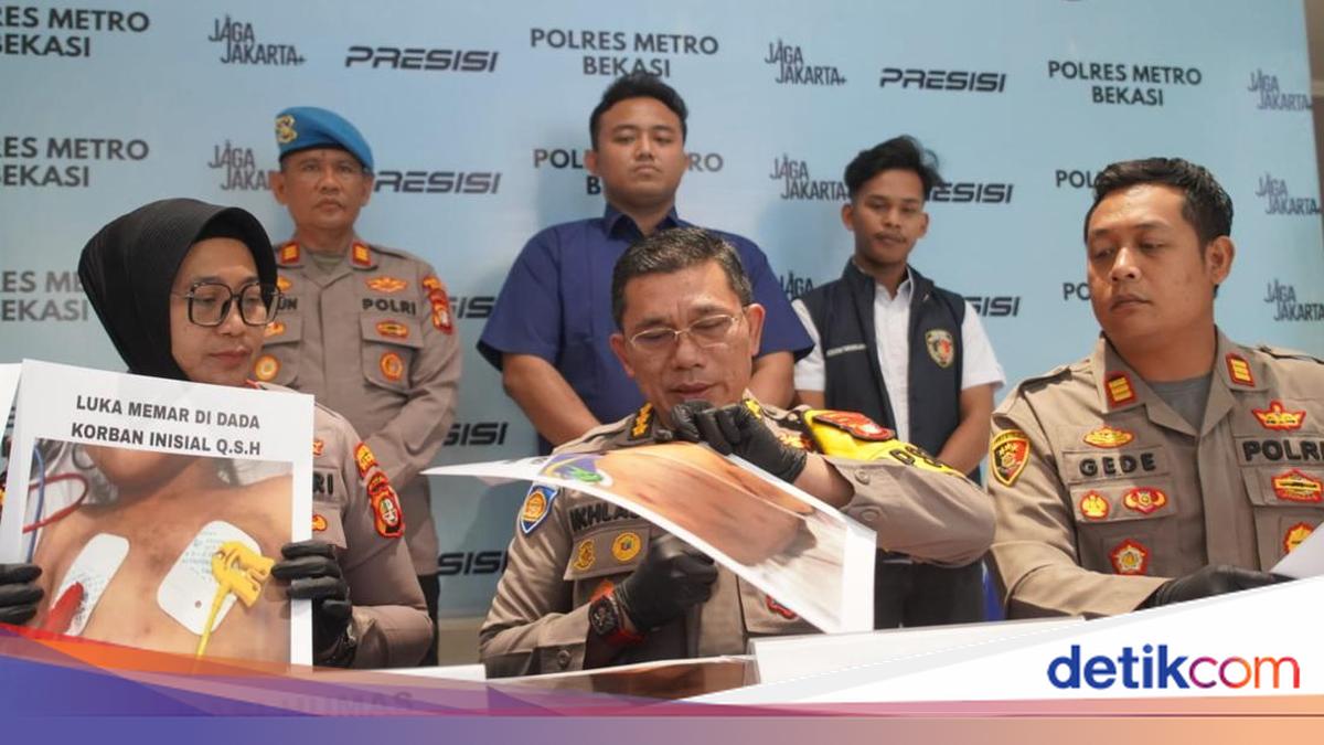 Bocah di Bekasi Dianiaya Ibu Tiri saat Ditinggal Ayah Kerja di Luar Negeri