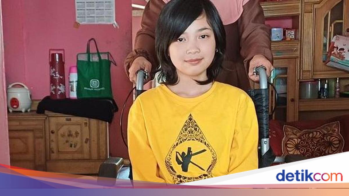 Sahabat Baik, Mari Bantu Osi Punya Kaki Palsu agar Bisa Lanjut Sekolah
