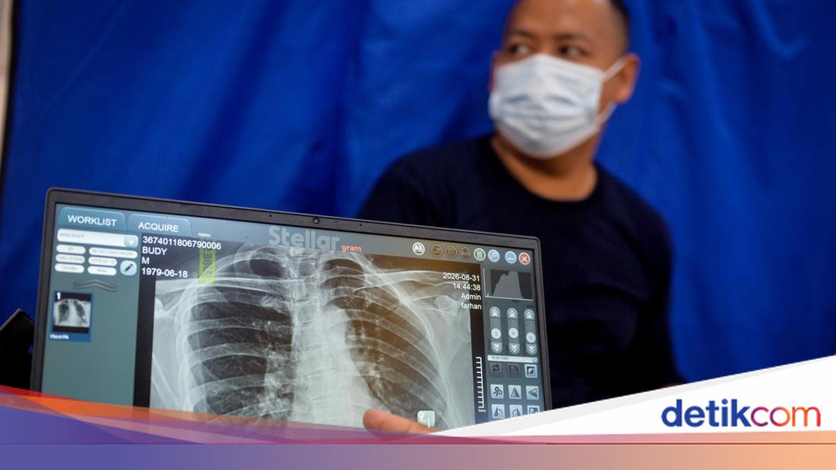 82 Juta Warga Sudah Ikuti Cek Kesehatan Gratis, Penyakit Ini Banyak Ditemukan