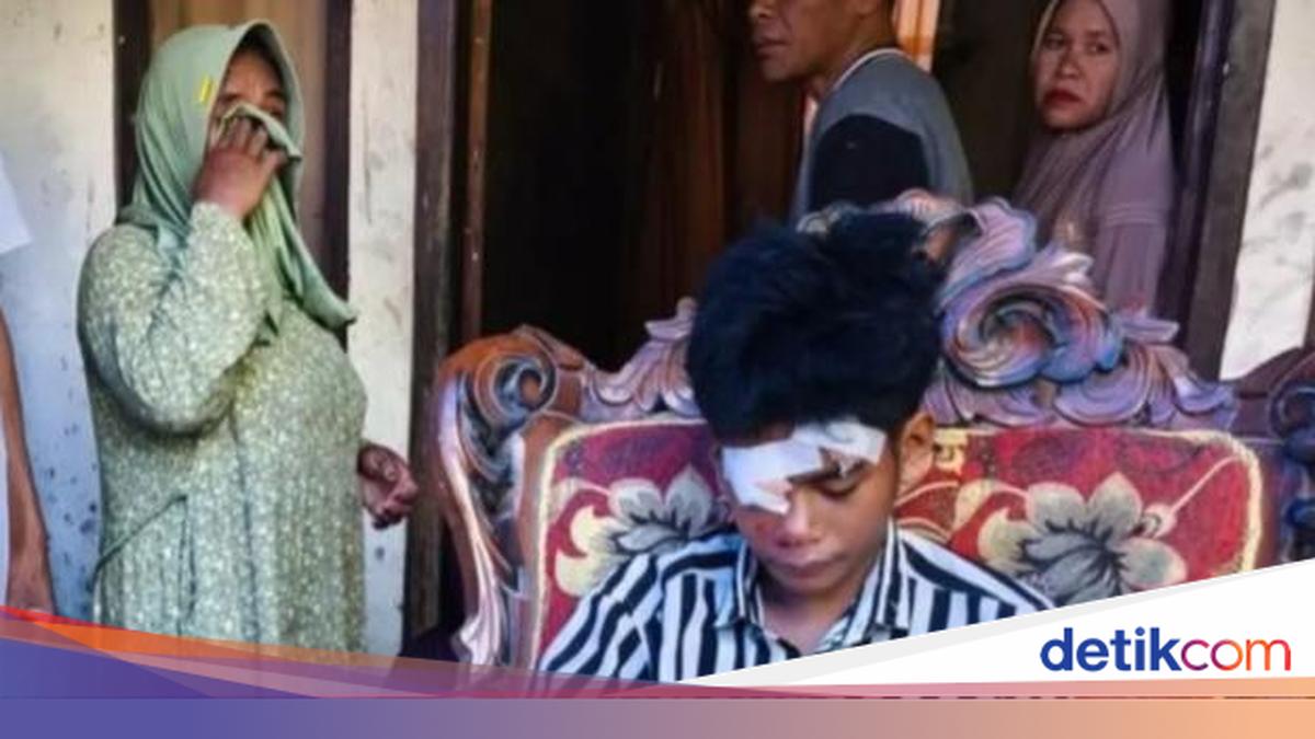 Kronologi 3 Penambang Emas Tewas Tertimbun Longsor di Sumbawa