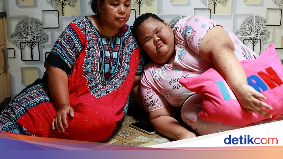 Kisah Pilu Remaja di Bogor Dibully dan Putus Sekolah karena Idap Obesitas