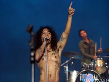 Perhatikan Penampilan-Kaka Transplantasi Rambut, Upaya Slank Tetap Relevan? Perhatikan Penampilan-Kaka Transplantasi Rambut, Upaya Slank Tetap Relevan?