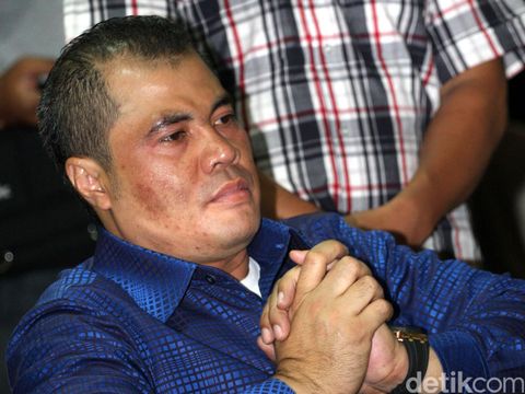 Mantan Bupati Garut Aceng Fikri
