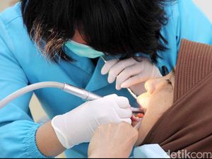 Catat, Ini Akibatnya Jika Malas Cek ke Dokter Gigi Minimal 6 Bulan Sekali