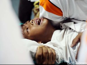 Anak Sering Garuk-garuk Mr P, Gejala Fimosis atau Minta Sunat?