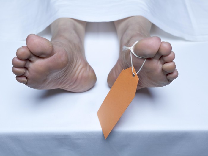 Dinyatakan Tewas karena Infeksi, Pria Ini Hidup Lagi Jelang Autopsi