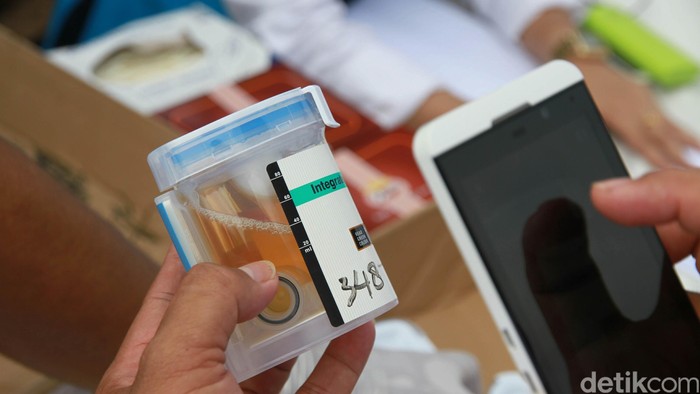 Aroma Urine Bisa Tunjukkan Risiko Alzheimer