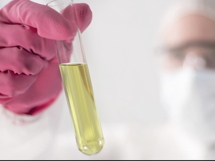 Kelak Kanker Pankreas Bisa Terdeteksi Sejak Dini Hanya dengan Tes Urine