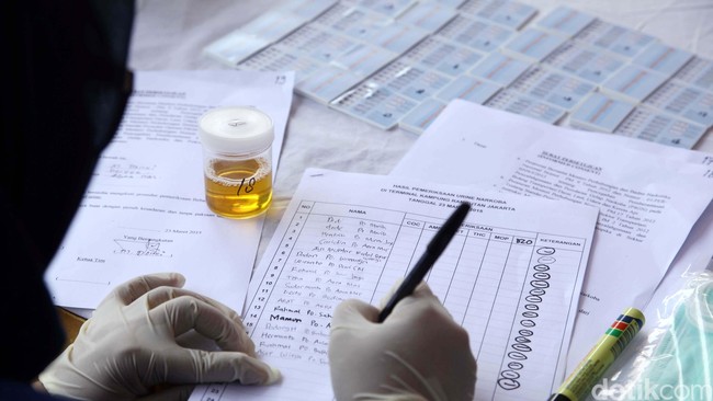 10 Warna Urine dan Artinya Bagi Kondisi Kesehatan (2)