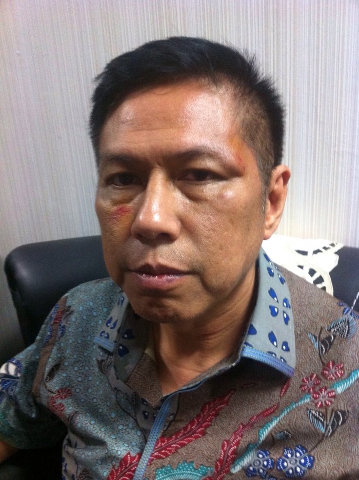 6 Bulan Dilaporkan ke Polda Metro, Apa Kabar Kasus Pemukulan Anggota DPR?