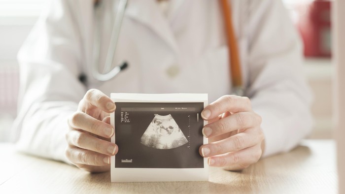 Meminimalkan Ketidaksesuaian Hasil, Haruskah Bumil Lakukan USG Tiap Kontrol?