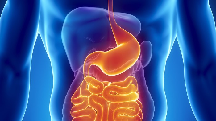 Deteksi Dini, Cara Paling Ampuh untuk Cegah Kanker Usus Besar