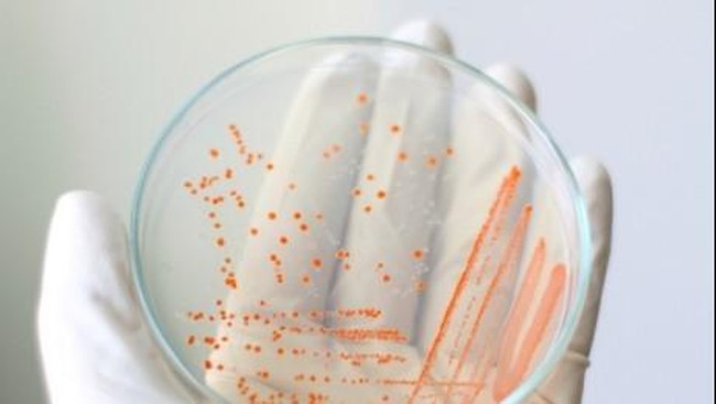 Kasus-kasus Infeksi Bakteri Pemakan Daging dari Berbagai Belahan Dunia