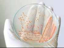 Hasil Lab Makanan Pemicu Keracunan di Gunungkidul Ditemukan Bakteri-Jamur