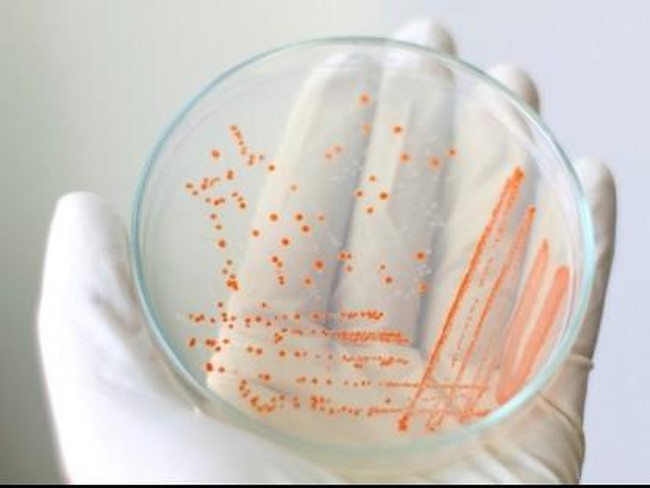 5 Benda Sehari-hari yang Bisa Jadi Sarang Bakteri