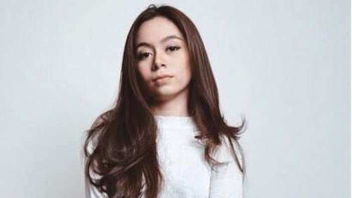 Kasus Artis Disiram Air Keras, Polisi Masih Periksa Saksi