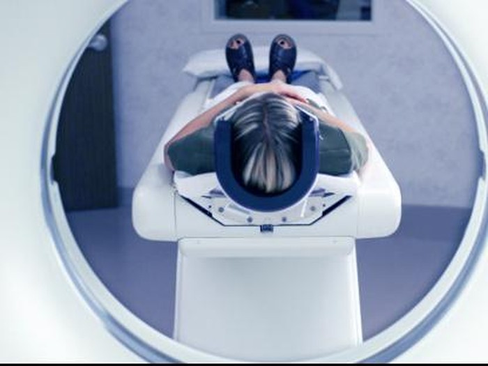 Fasih Lebih dari Satu Bahasa, Pasien Mudah Sembuh Pasca Stroke