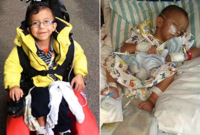 Bocah Ini Akhirnya Bisa ke Toilet Berkat Suntik Botox