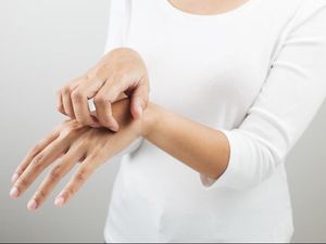 Kenapa Bekas Herpes Zoster Masih Terasa Gatal? Begini Penjelasannya