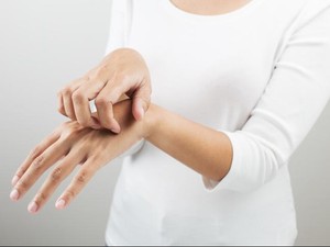 Norwegian Scabies, Ketika di Satu Tubuh Seseorang Bersemayam Ribuan Kutu