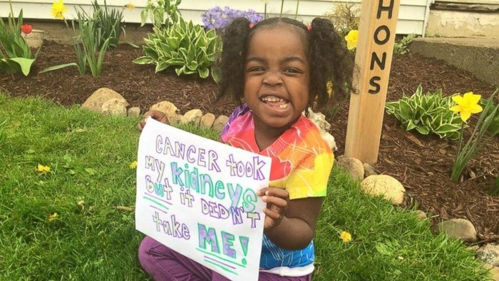 Ada Tumor di Ginjal, Bocah 4 Tahun Ini Harus Makan Melalui Feeding Tube