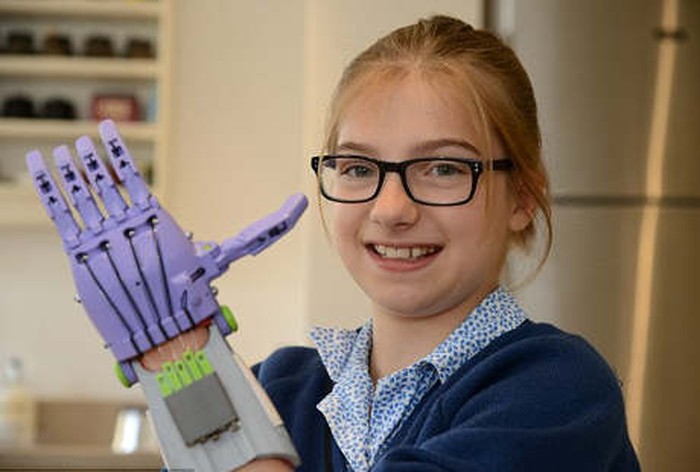 Lahir dengan Satu Tangan, Lara Dibuatkan Tangan Prostetik oleh Teman-temannya