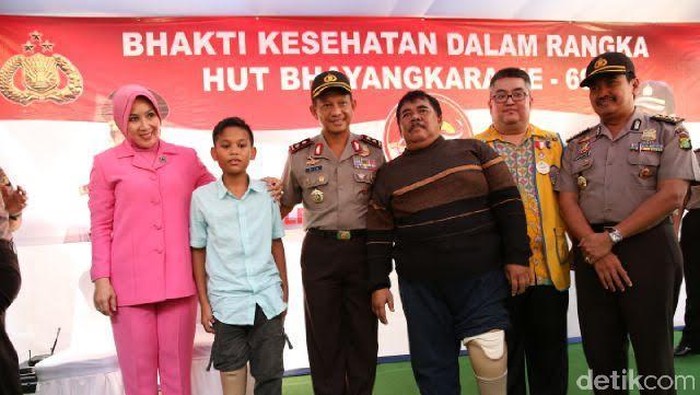 HUT Bhayangkara, Kapolda Metro Sumbang Kaki Palsu ke Korban Kecelakaan