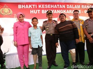 HUT Bhayangkara, Kapolda Metro Sumbang Kaki Palsu ke Korban Kecelakaan