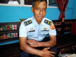 Pelda Bambang Hercules Mensyukuri Hidup Kedua Pasca Kecelakaan Hercules