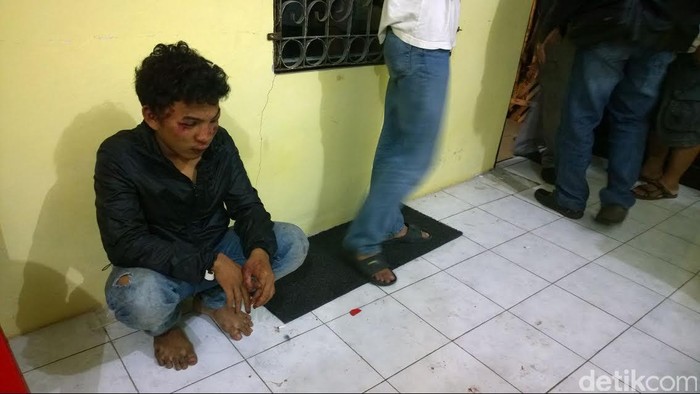Pria ini Babak Belur Jadi Korban Tawuran Warga Utan Kayu dan Pulo Gadung