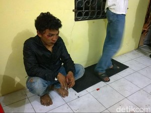 Pria ini Babak Belur Jadi Korban Tawuran Warga Utan Kayu dan Pulo Gadung