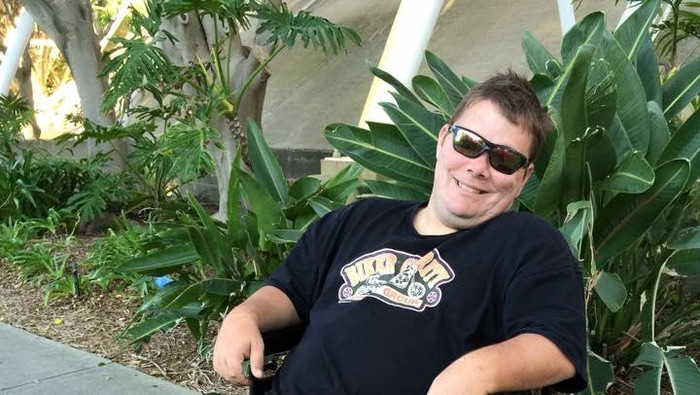 Kondisi Langka, Skrotum Tyrone Membengkak Hingga Sebesar Semangka