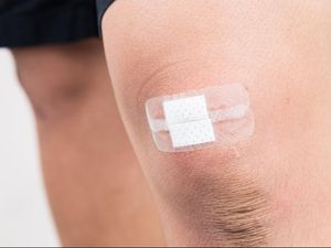 Begini Cara Bakteri Antraks Menular ke Manusia