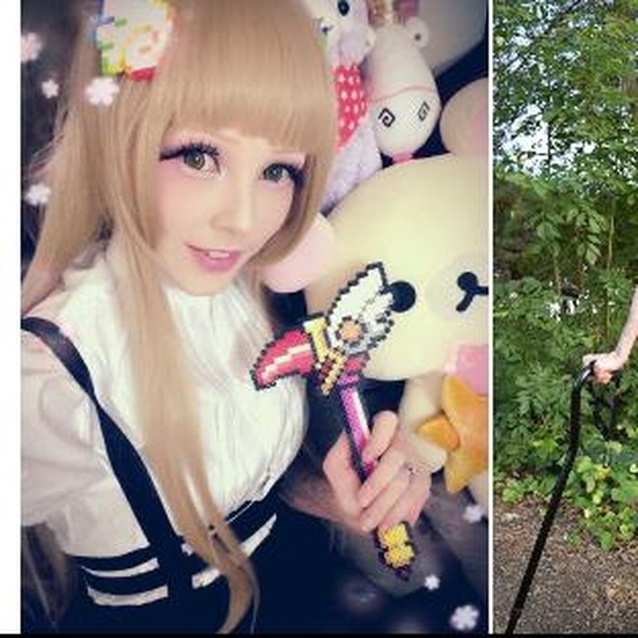 Idap Distrofi Otot, Wanita Ini Jadi Boneka Barbie Hidup di Dunia Nyata