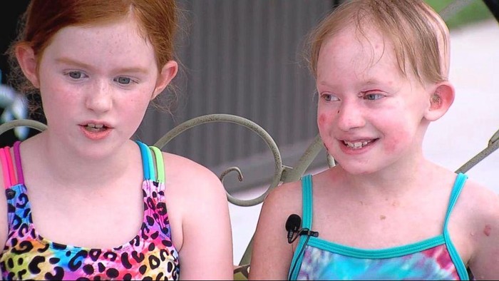 Sukses Jualan Gelang Demi Bantu Teman Baik yang Sakit Kulit Langka