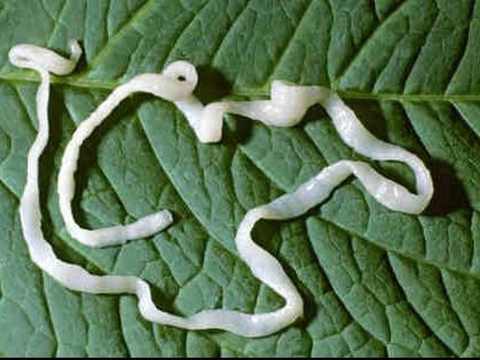 Akibat Cacing di Tubuhnya Kena Kanker, Pria Ini Meninggal