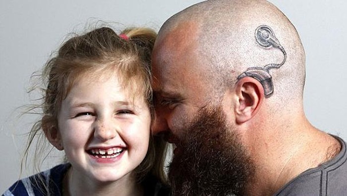 Dukung Putrinya, Alistair Bikin Tato Gambar Implan Koklea
