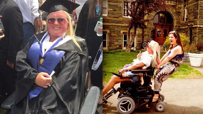 Dipukul Sedikit, Otot dan Sendi Wanita Ini Bisa Menyatu Jadi Tulang