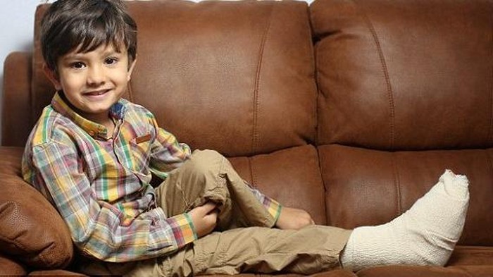 Terjebak Tiga Jam di Eskalator, Kaki Bocah 6 Tahun Ini Nyaris Diamputasi