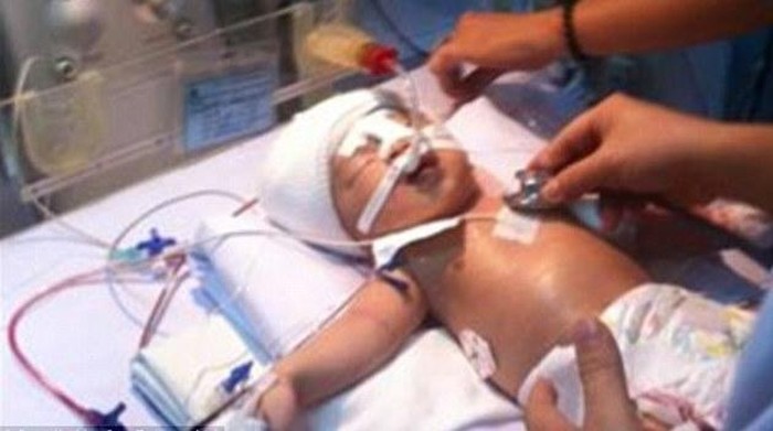 Panik Saat Beraksi, Pencuri Tikam Kepala Bayi di Rumah Sakit