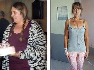 Diet Ekstrem dan Asup 100 Kalori Sehari, Kini Victoria Lawan Anoreksia