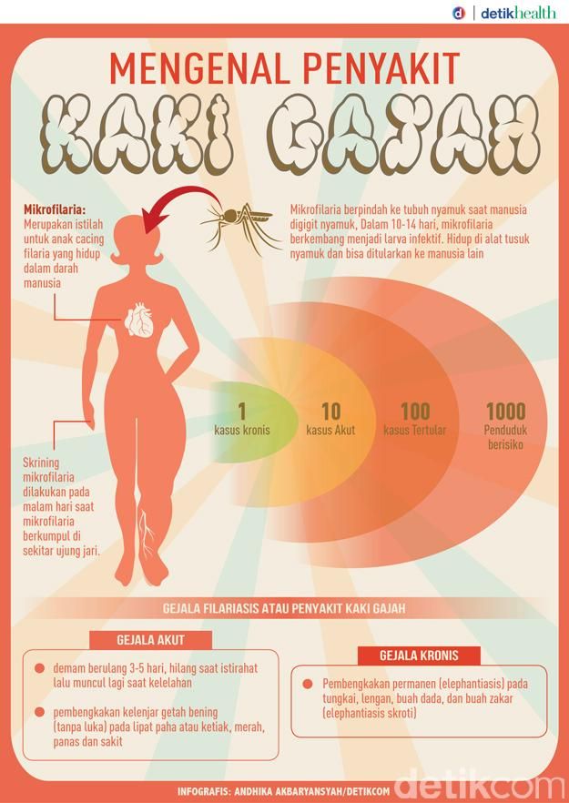 Daya Tular Tinggi, Jangan Abaikan Kondisi yang Dicurigai Gejala Kaki Gajah