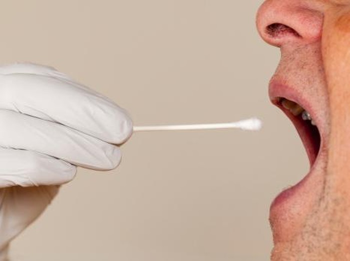 Yuk, Kenali Penyebab dan Faktor Risiko Kanker Mulut