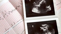 Fakta Baru Kasus Sejoli Aborsi 7 Janin-Disimpan di Kosan Selama 10 Tahun