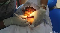 Managing Director CT Foundation, Ratna Cary menyebut caries atau gigi berlubang paling banyak ditemukan pada anak-anak. Hampir semua ada caries, terutama gigi atas dan belakang, katanya. (Foto: Uyung/detikHealth)