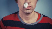 Pada beberapa kasus langka, mimisan bisa muncul sebagai tanda adanya tumor. Mimisan yang patut diwaspadai adalah yang terjadi berulang dan berlangsung lama. (Foto: Thinkstock)