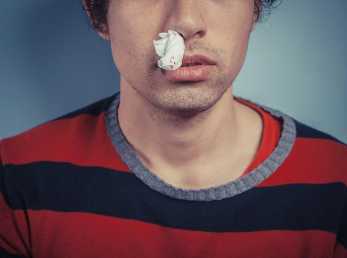 Di dalam membran hidung yang sensitif terdapat banyak pembuluh darah. (Foto: Thinkstock) Di dalam membran hidung yang sensitif terdapat banyak pembuluh darah. (Foto: Thinkstock)
