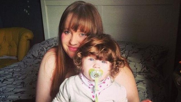 Bocah Ini Punya Rambut Lebat, Tak Tahunya Gejala Penyakit Langka